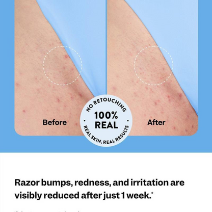 Smoothing Solution Ingrown Hair Treatment