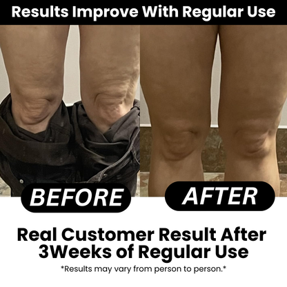 SmoothRise™ Anti-cellulite Massage Oil